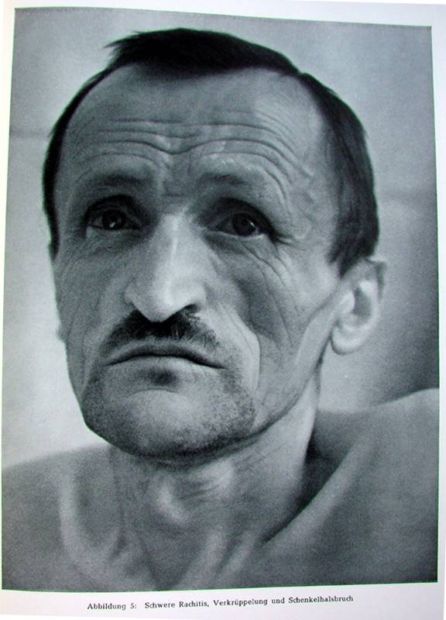 Жесть! Фотографии смертельно больных людей.