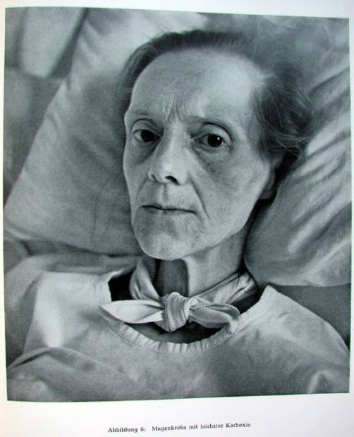 Жесть! Фотографии смертельно больных людей.