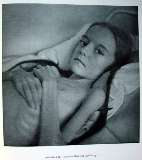 Жесть! Фотографии смертельно больных людей.