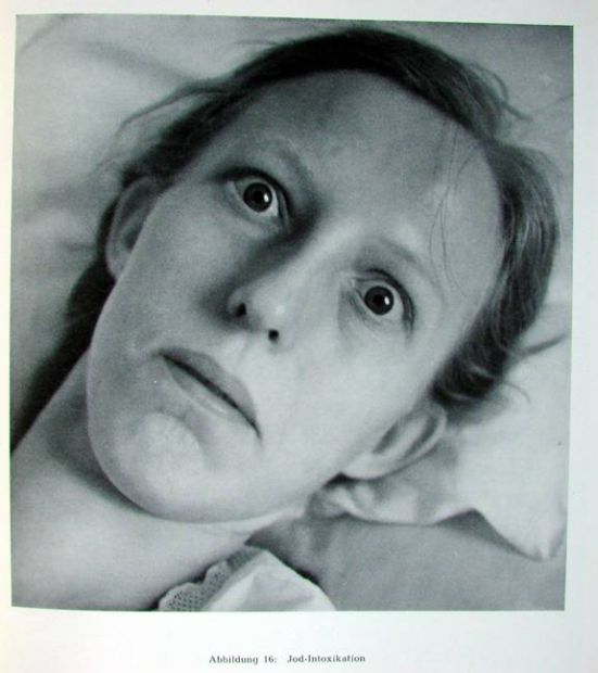 Жесть! Фотографии смертельно больных людей.