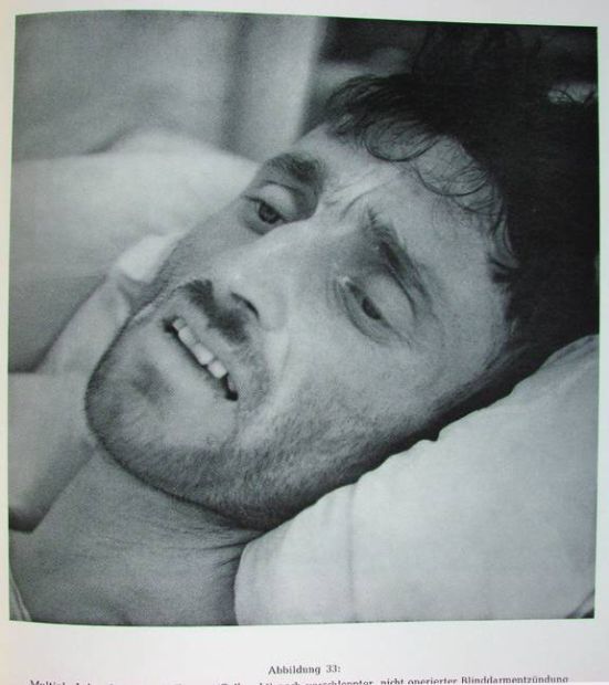 Жесть! Фотографии смертельно больных людей.