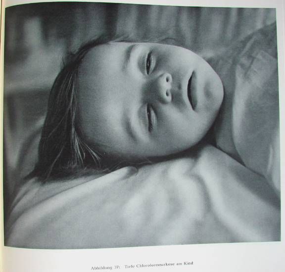 Жесть! Фотографии смертельно больных людей.