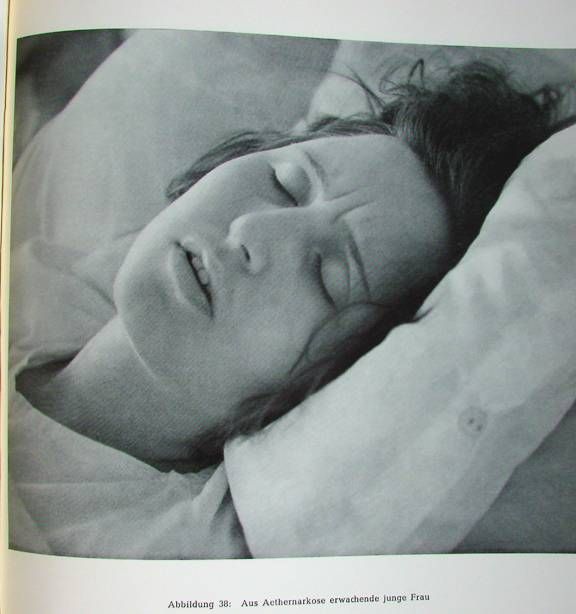 Жесть! Фотографии смертельно больных людей.