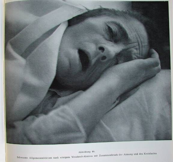 Жесть! Фотографии смертельно больных людей.