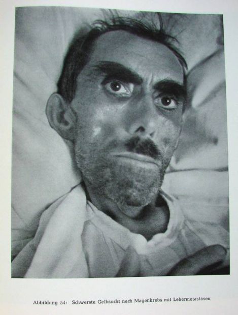 Жесть! Фотографии смертельно больных людей.