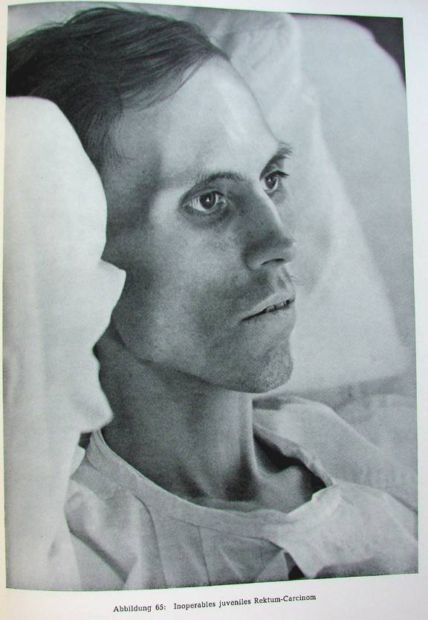 Жесть! Фотографии смертельно больных людей.