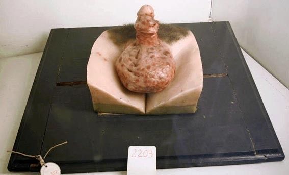 Кунсткамера