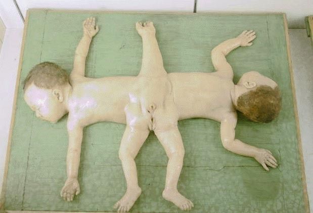 Кунсткамера