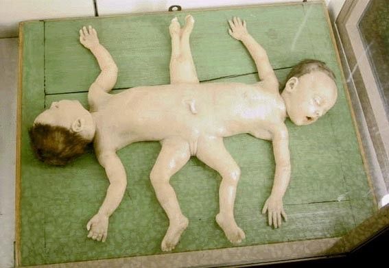 Кунсткамера