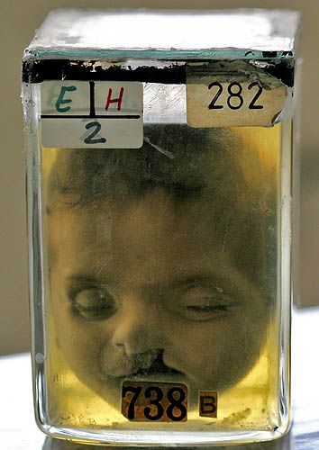 ����� ��������