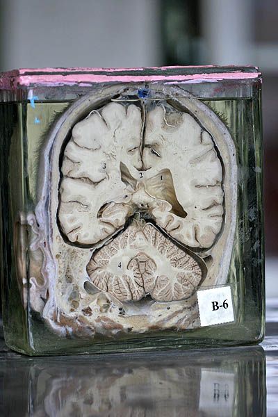 ����� ��������