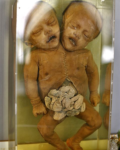 ����� ��������