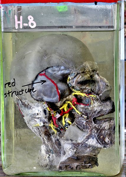 ����� ��������