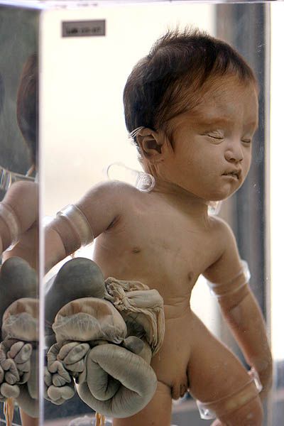 ����� ��������