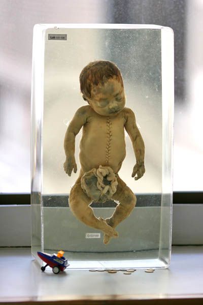 ����� ��������