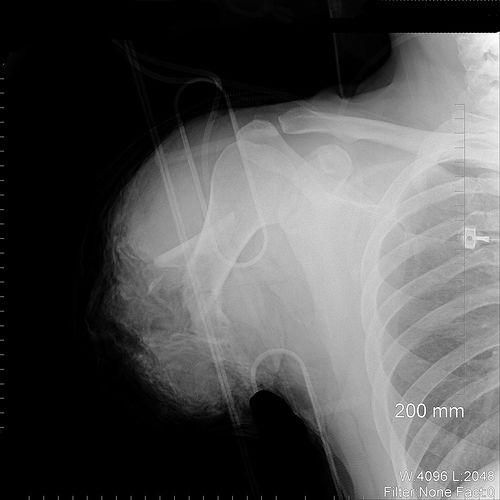 Необычные рентгеновские снимки