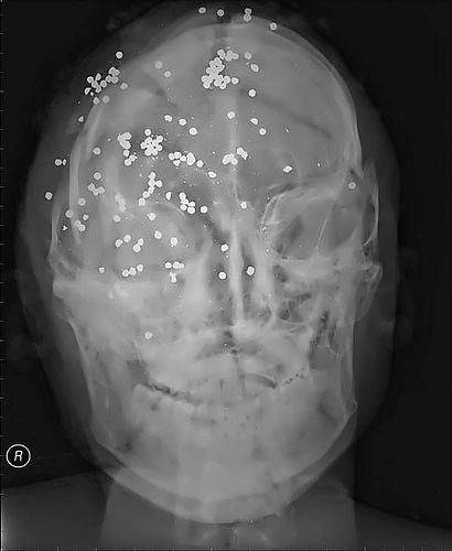 Необычные рентгеновские снимки
