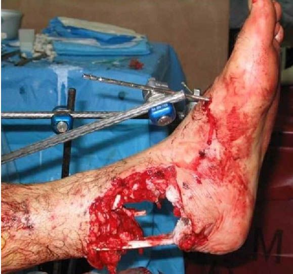 �����! ��������� ������ �������!