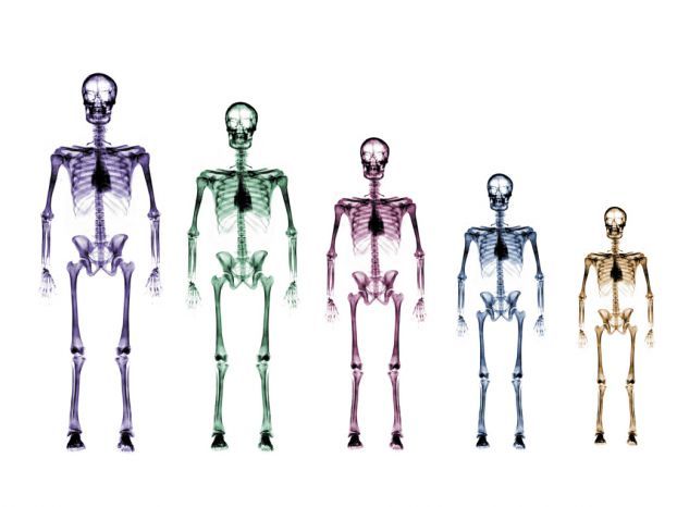 skeletons